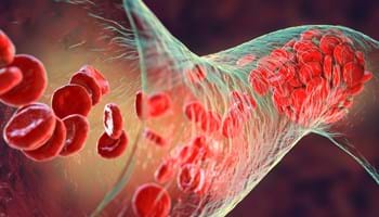 Why Believe In God (1)? - The Complexity Of Our Bodies Demands A Creator