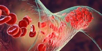 Why Believe In God (1)? - The Complexity Of Our Bodies Demands A Creator